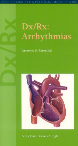 Dx/Rx: Arrhythmias