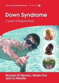 Down Syndrome: Current Perspectives