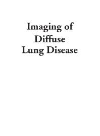 Imaging of Diffuse Lung Disease