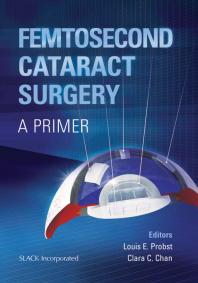 Femtosecond Cataract Surgery: A Primer