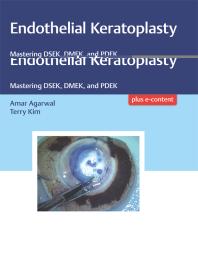 Endothelial Keratoplasty: Mastering DSEK, DMEK, and PDEK