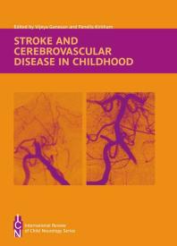 Stroke and Cerebrovascular Disease in Childhood