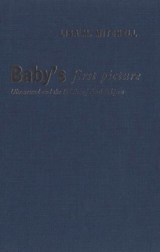 Baby's First Picture: Ultrasound and the Politics of Fetal Subjects