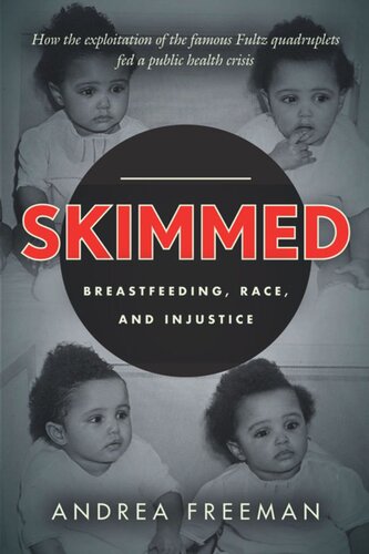 Skimmed: Breastfeeding, Race, and Injustice