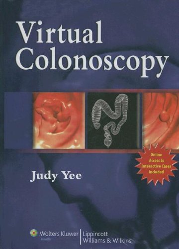 Virtual Colonoscopy