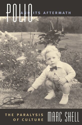 Polio and Its Aftermath: The Paralysis of Culture