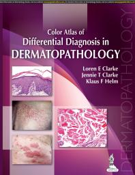 Color Atlas of Differential Diagnosis in Dermatopathology