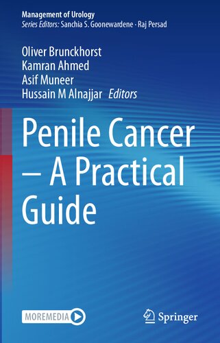 Penile Cancer – A Practical Guide (Management of Urology)