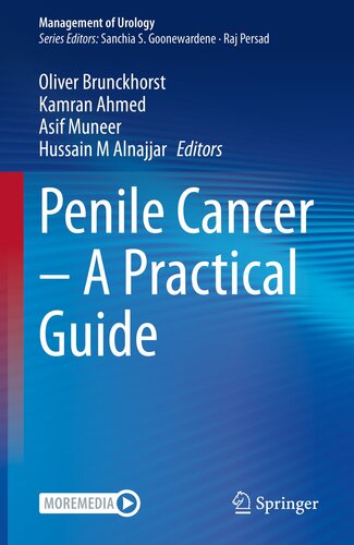 Penile Cancer – A Practical Guide (Management of Urology)