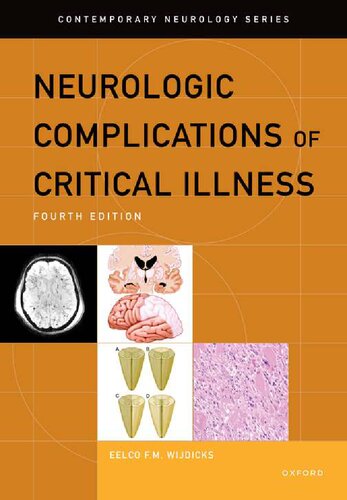 Neurologic Complications of Critical Illness (CONTEMPORARY NEUROLOGY SERIES) [Team-IRA]