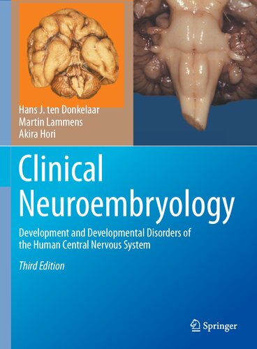 Clinical Neuroembryology: Development and Developmental Disorders of the Human Central Nervous System