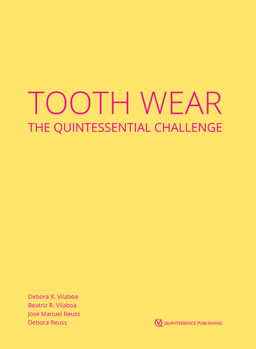 Tooth Wear: The Quintessential Challenge