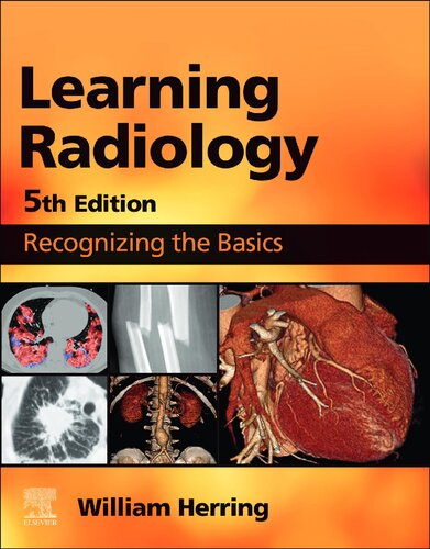 LEARNING RADIOLOGY,