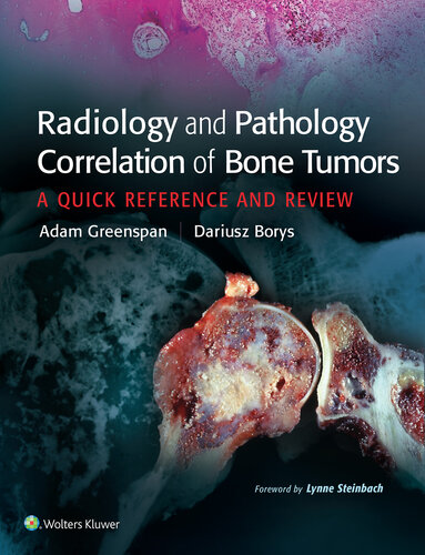 Radiology and Pathology Correlation of Bone Tumors, None: A Quick Reference and Review