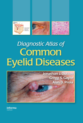 Diagnostic Atlas of Common Eyelid Diseases