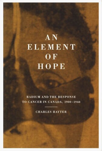 Element of Hope: Radium and the Response to Cancer in Canada, 1900-1940