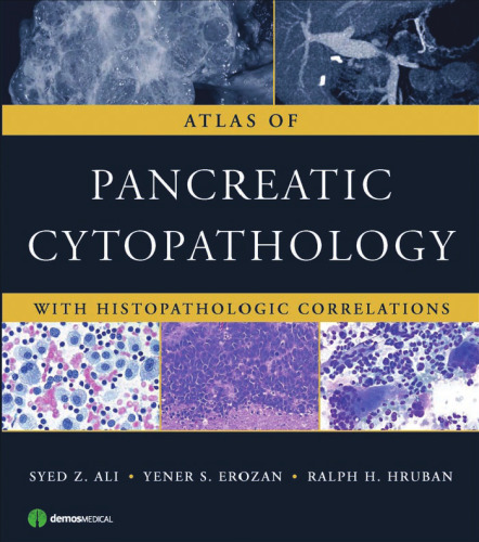 Atlas of Pancreatic Cytopathology with Histopathologic Correlations