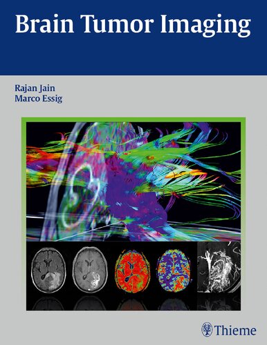 Brain Tumor Imaging