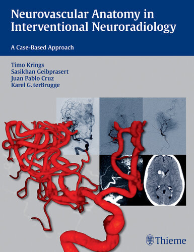 Neurovascular anatomy in interventional neuroradiology a case-based approach
