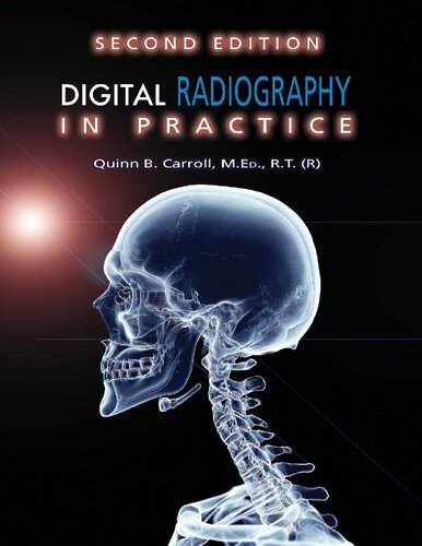 Digital Radiography in Practice [Team-IRA]