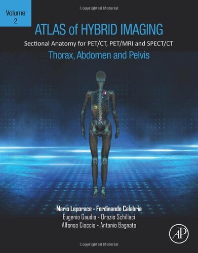 Atlas of Hybrid Imaging Sectional Anatomy for PET/CT, PET/MRI and SPECT/CT Vol. 2: Thorax Abdomen and Pelvis: Sectional Anatomy for PET/CT, PET/MRI and SPECT/CT