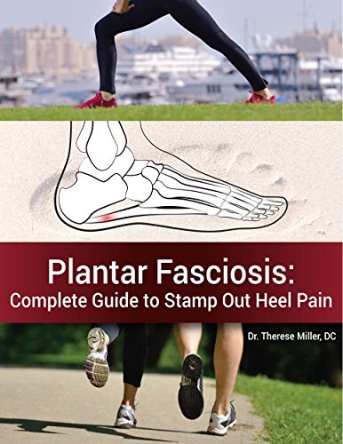 Plantar Fasciosis: The Complete Guide to Stamping Out Heel Pain