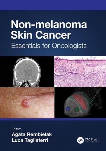 Non-melanoma Skin Cancer: Essentials for Oncologists (Series in Medical Physics and Biomedical Engineering)