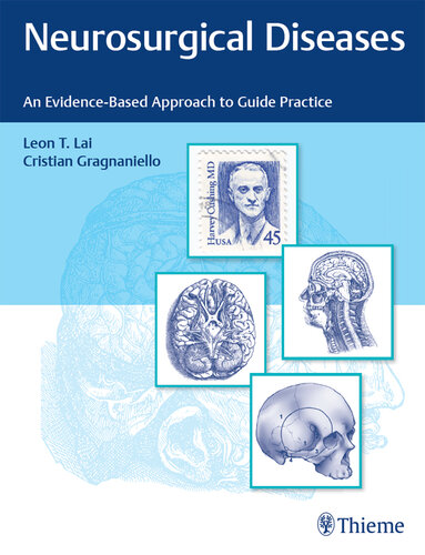 Neurosurgical Diseases: An Evidence-Based Approach to Guide Practice