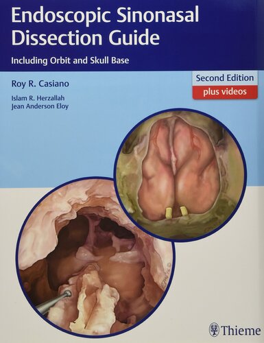 Endoscopic Sinonasal Dissection Guide: Including Orbit and Skull Base