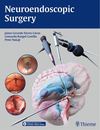 Neuroendoscopic Surgery