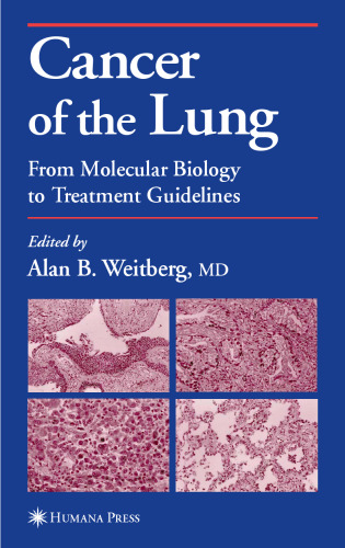 Cancer of the Lung: From Molecular Biology to Treatment Guidelines (Current Clinical Oncology)