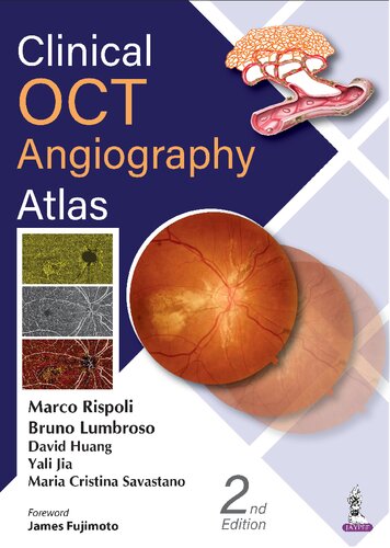 Clinical OCT Angiography Atlas