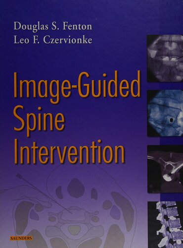 Image-Guided Spine Intervention