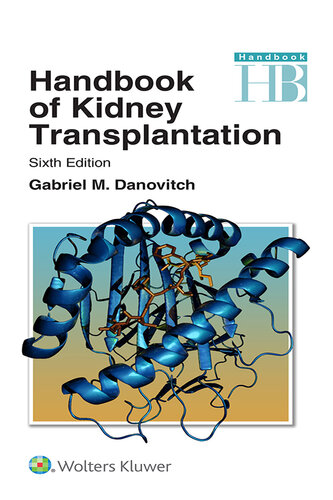 Handbook of Kidney Transplantation