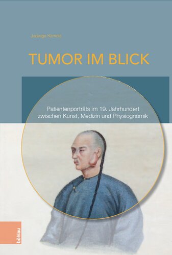 Tumor im Blick: Patientenporträts im 19. Jahrhundert zwischen Kunst, Medizin und Physiognomik
