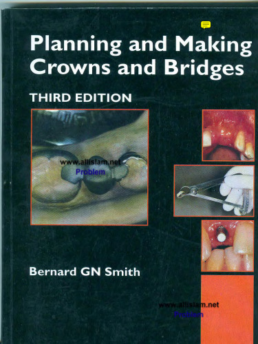 Planning and Making Crowns and Bridges 3rd Edition