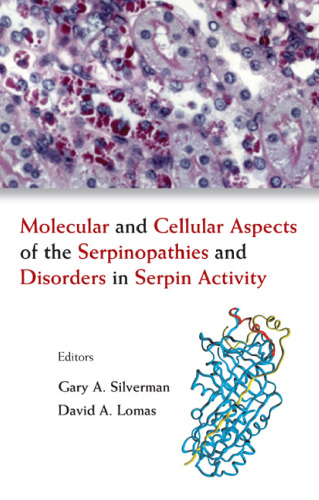 Molecular and Cellular Aspects of the Serpinopathies and Disorders in Serpin Activity