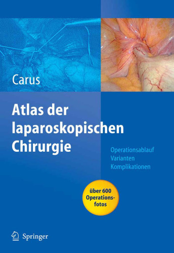 Atlas der laparoskopischen Chirurgie - Operationsverlauf, Varianten, Komplikationen