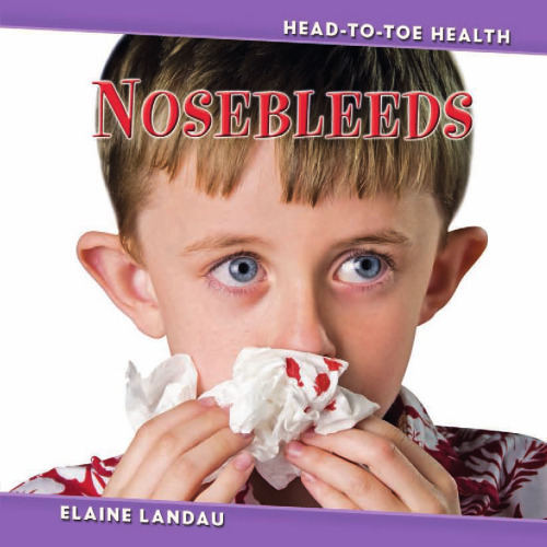 Nosebleeds (Head-to-Toe Health)