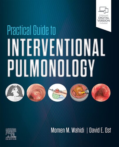 Practical Guide to Interventional Pulmonology
