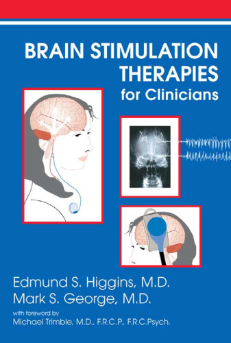 Brain Stimulation Therapies for the Clinician