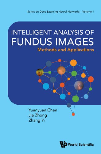 Intelligent Analysis of Fundus Images. Methods and Applications