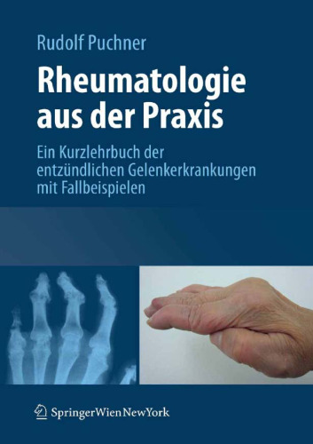 Rheumatologie aus der Praxis: Kurzlehrbuch der entzundlichen Gelenkerkrankungen mit Fallbeispielen