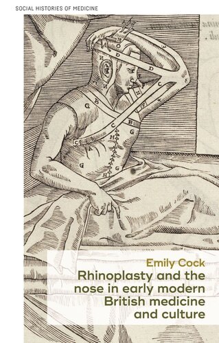 Rhinoplasty and the nose in early modern British medicine and culture