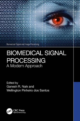 Biomedical Signal Processing. A Modern Approach