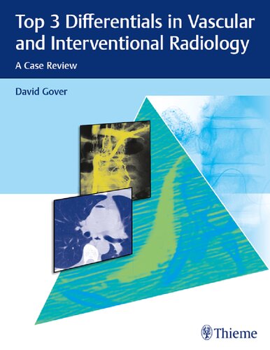Top 3 Differentials in Vascular and Interventional Radiology: A Case Review