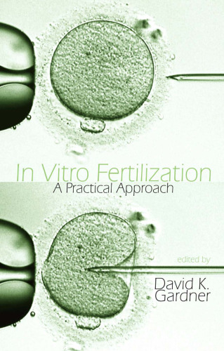 In Vitro Fertilization: A Practical Approach