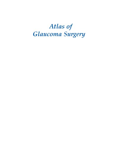 Atlas of Glaucoma Surgery