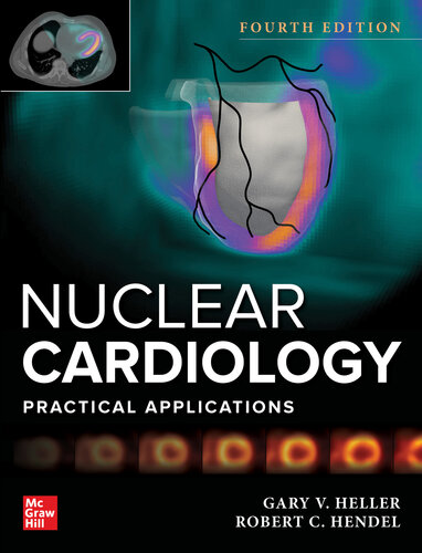 Nuclear Cardiology: Practical Applications