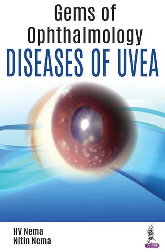 Gems of Ophthalmology: Diseases of Uvea